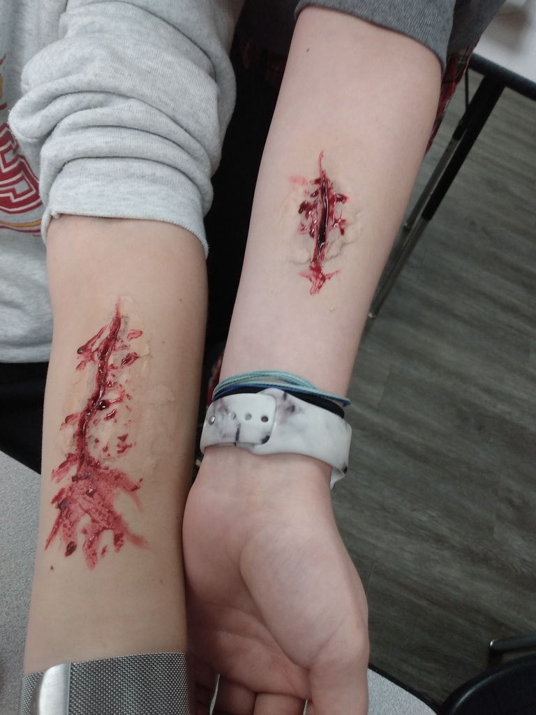 Cuts